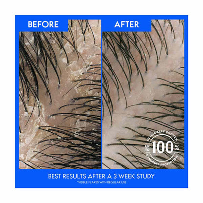 Head & Shoulders Classic Clean Daily Shampoo, 3 fl oz